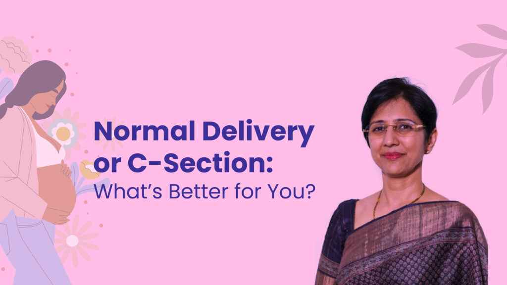 Normal Delivery or C-Section: What’s Better for You?