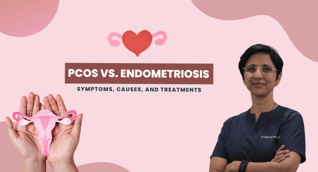 PCOS vs. Endometriosis: Symptoms, Causes, and Treatments Explained