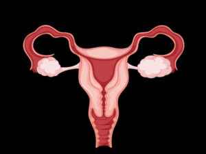 Read more about the article Ovarian Fibroma – Is It an Ovarian Cancer?