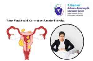 Read more about the article What You Should Know about Uterine Fibroids?
