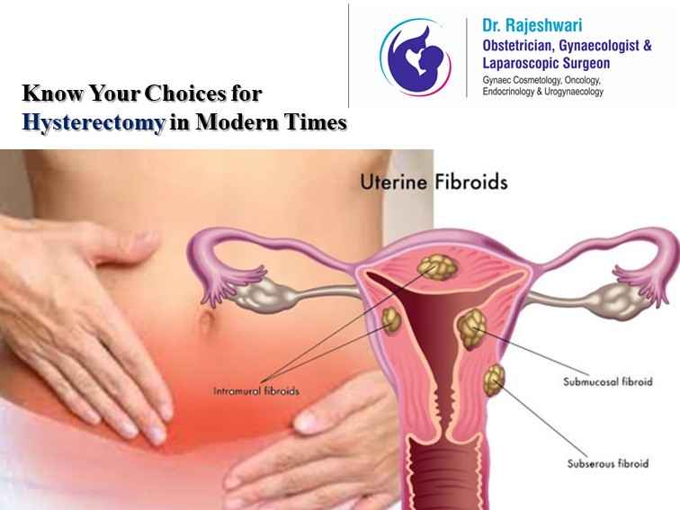 You are currently viewing Know Your Choices for Hysterectomy in Modern Times