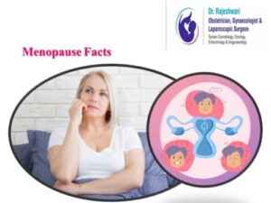 Read more about the article Menopause – What You Need to Know?