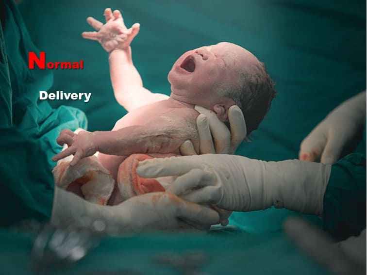 Read more about the article What is Normal Delivery / Childbirth?