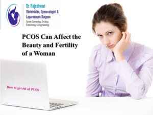Read more about the article PCOS Can Affect Beauty and Fertility of a Woman
