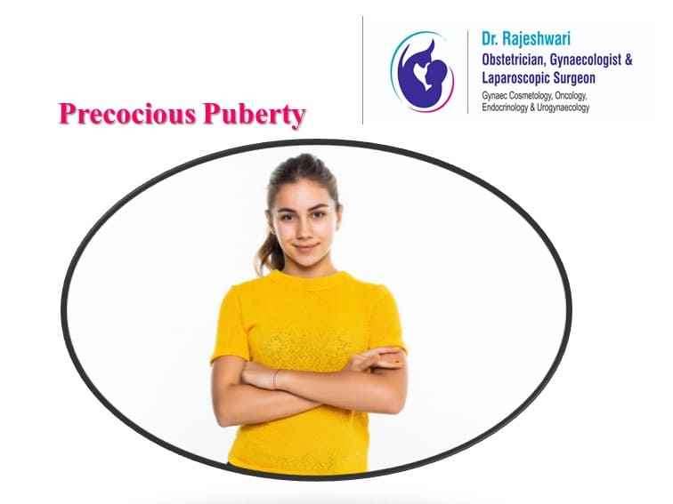 You are currently viewing Precocious Puberty (Early Puberty in Girls)