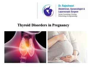 Read more about the article Thyroid Disorders in Pregnancy