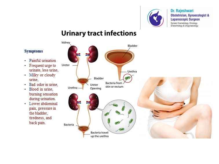 You are currently viewing Take Urinary Tract Infections Seriously