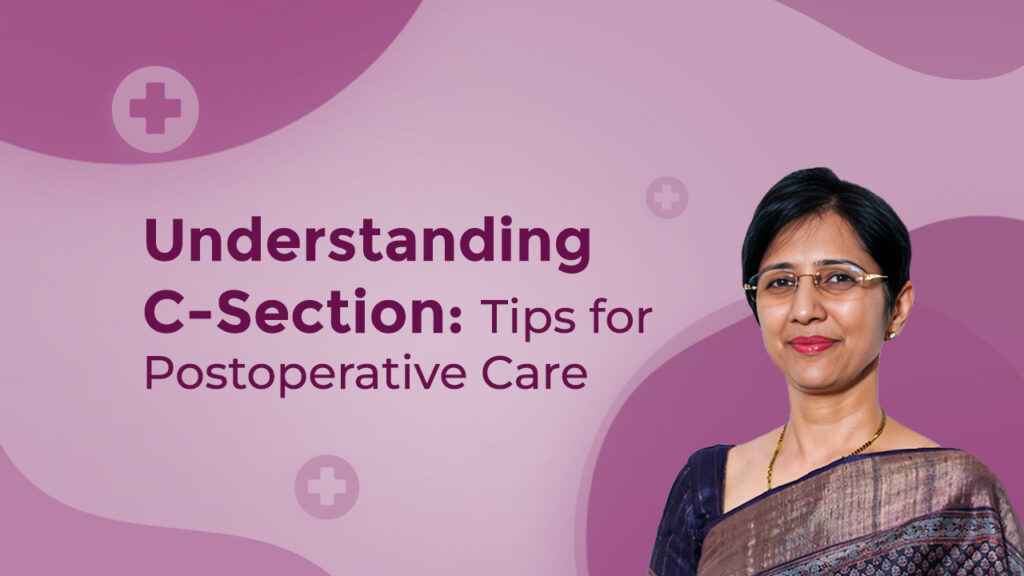 Understanding C-Section: Tips for Postoperative Care