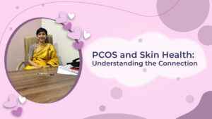 Read more about the article PCOS and Skin Health: Understanding the Connection