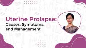 Read more about the article Understanding Uterine Prolapse: Causes, Symptoms, and Management